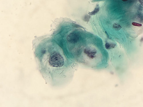 pap_hpv_citolab03