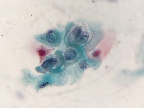 pap_hpv_citolab03