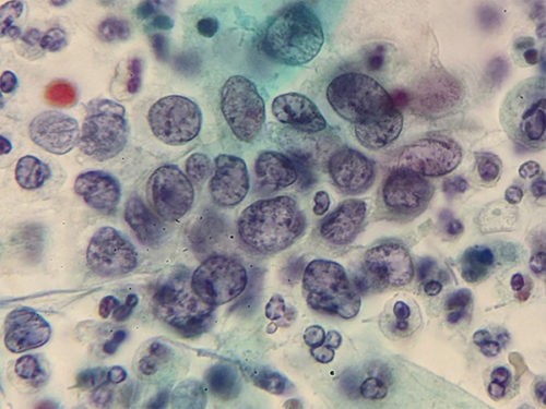 pap_hpv_citolab04